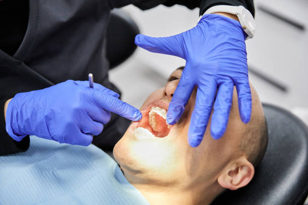 Best Emergency Treatment for Dental Infections or Abscesses in Henderson, NV